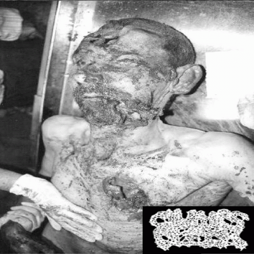 Clumps Of Flesh : Corpse Mutilation